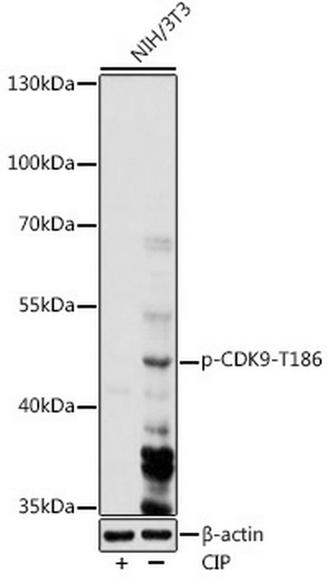 Phospho-CDK9 (Thr186) Antibody in Western Blot (WB)