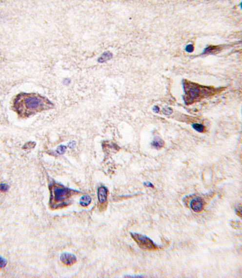 PDGF-A Antibody in Immunohistochemistry (Paraffin) (IHC (P))