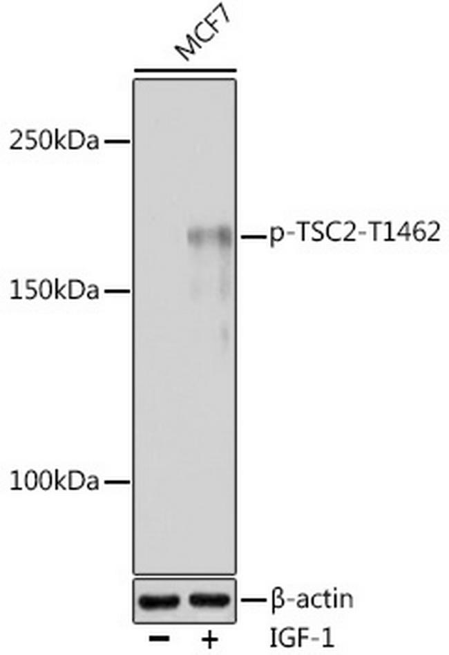 Phospho-TSC2 (Thr1462) Antibody in Western Blot (WB)