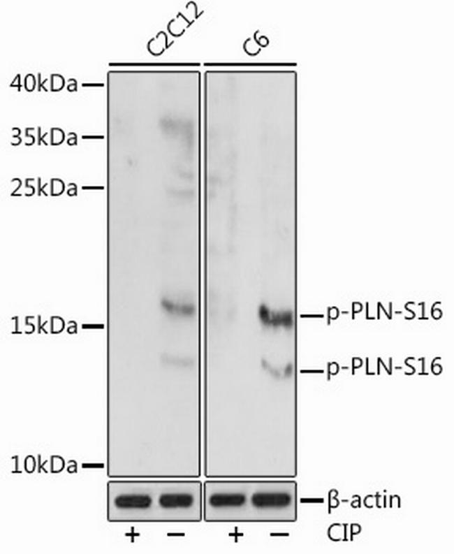 Phospho-Phospholamban (Ser16) Antibody in Western Blot (WB)