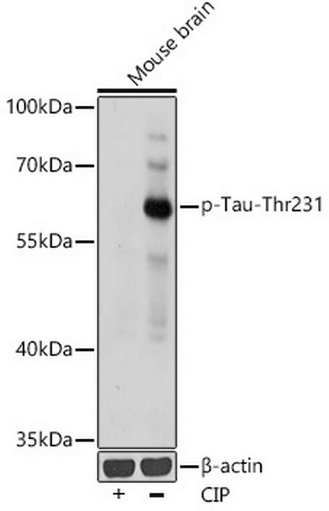 Phospho-Tau (Thr231) Antibody in Western Blot (WB)