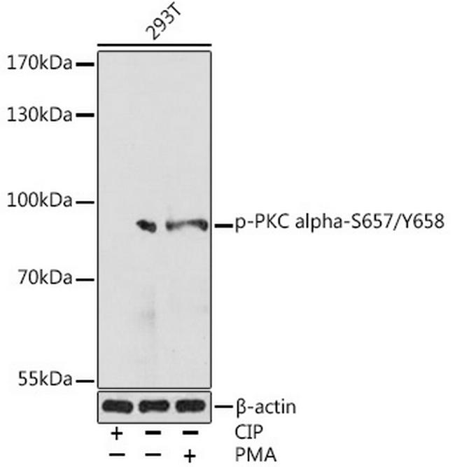 Phospho-PKC alpha (Ser657, Tyr658) Antibody in Western Blot (WB)