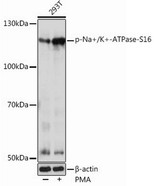 Phospho-ATP1A1 (Ser16) Antibody in Western Blot (WB)