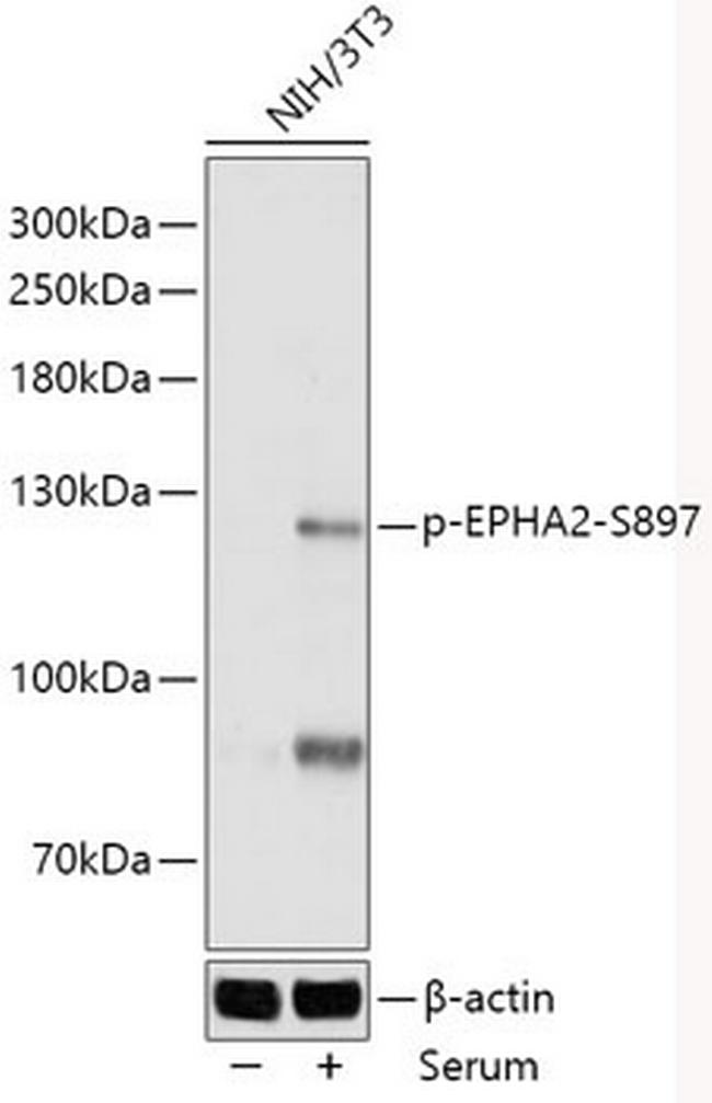 Phospho-EphA2 (Ser897) Antibody in Western Blot (WB)