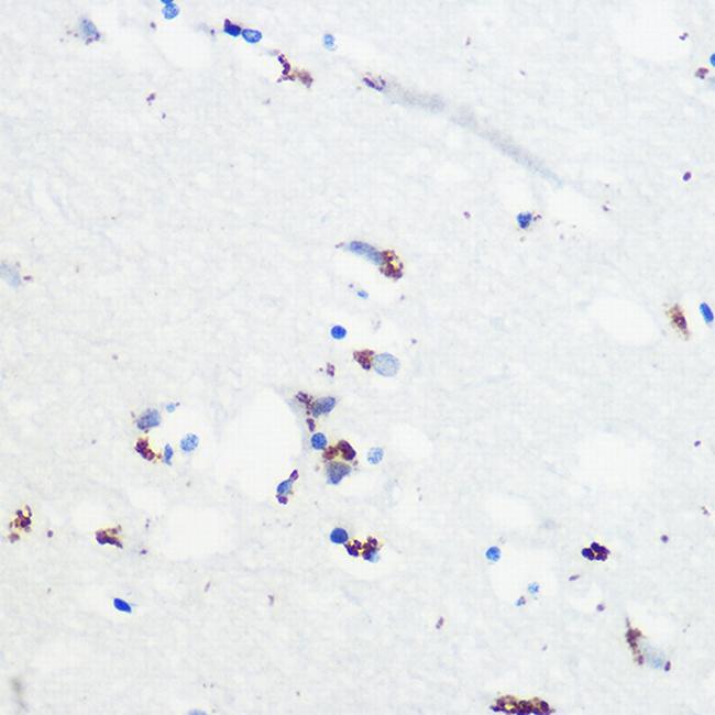 Phospho-Tau (Ser416) Antibody in Immunohistochemistry (Paraffin) (IHC (P))