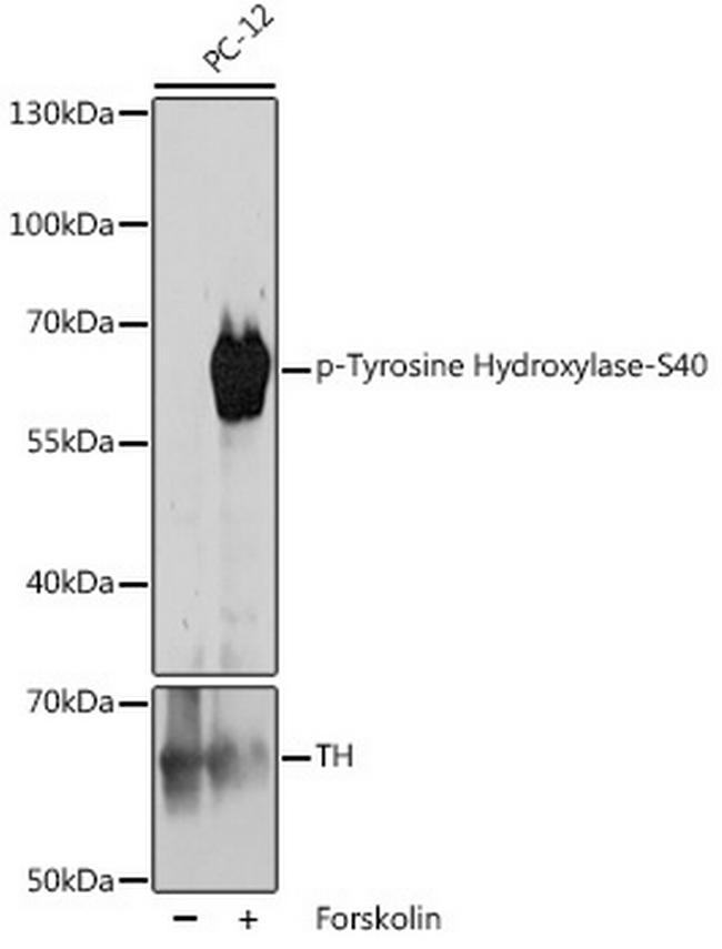 Phospho-Tyrosine Hydroxylase (Ser40) Antibody in Western Blot (WB)