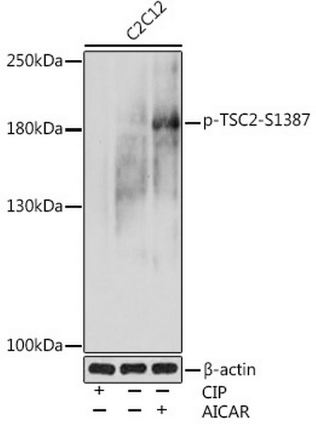 Phospho-TSC2 (Ser1387) Antibody in Western Blot (WB)