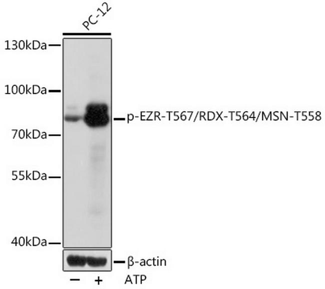 Phospho-Ezrin/Radixin/Moesin (Thr558, Thr567, Thr564) Antibody in Western Blot (WB)