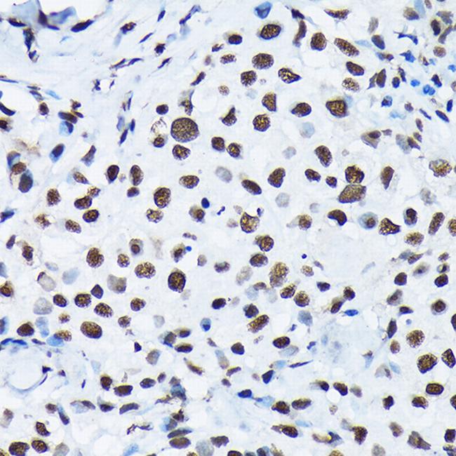 Phospho-c-Jun (Ser63) Antibody in Immunohistochemistry (Paraffin) (IHC (P))