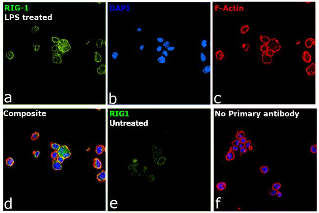 RIG-I Antibody in Immunocytochemistry (ICC/IF)