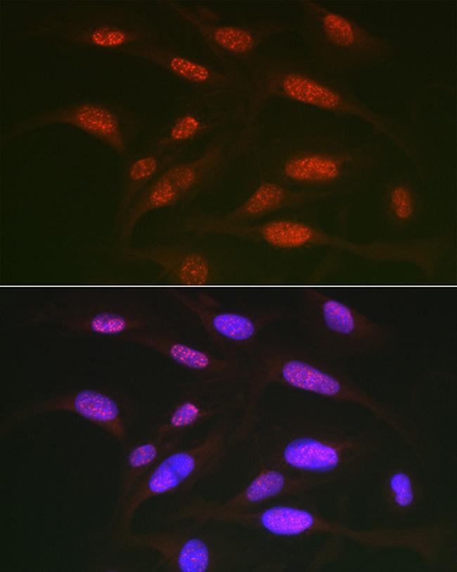 Phospho-c-Jun (Thr91) Antibody in Immunocytochemistry (ICC/IF)