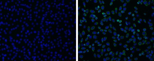 Japanese Encephalitis Virus NS1 Antibody in Immunocytochemistry (ICC/IF)