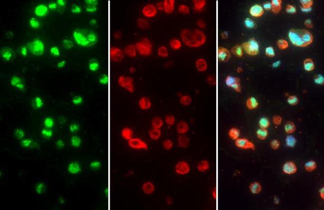 ZFP36 Antibody in Immunocytochemistry (ICC/IF)