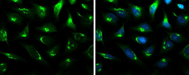 B4GALT1 Antibody in Immunocytochemistry (ICC/IF)