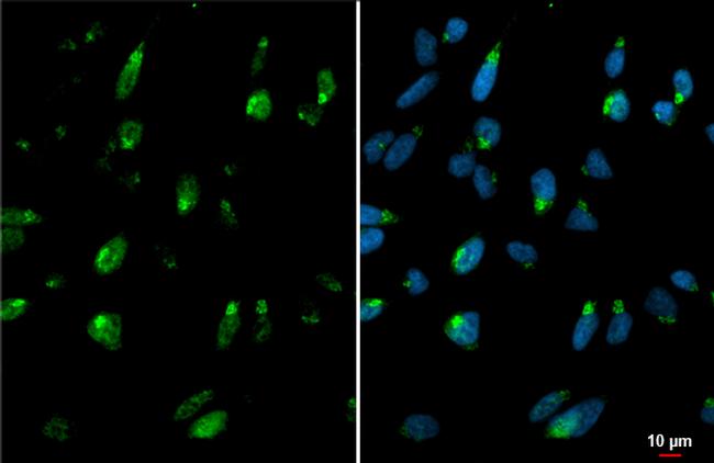 GALNT3 Antibody in Immunocytochemistry (ICC/IF)