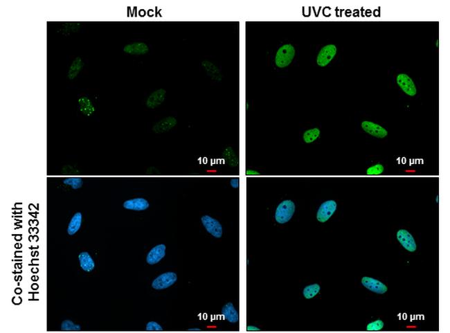 Phospho-CHK1 (Ser317) Antibody in Immunocytochemistry (ICC/IF)