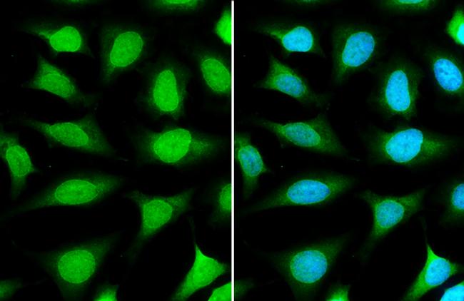 NUP153 Antibody in Immunocytochemistry (ICC/IF)