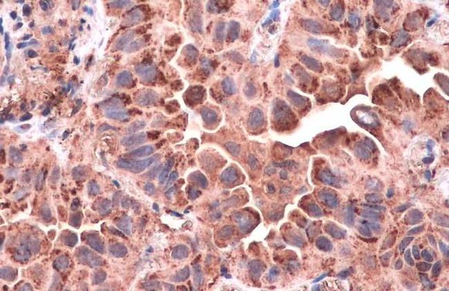 CD63 Antibody in Immunohistochemistry (Paraffin) (IHC (P))