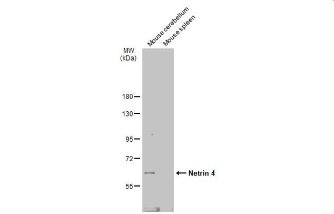 Netrin 4 Antibody in Western Blot (WB)