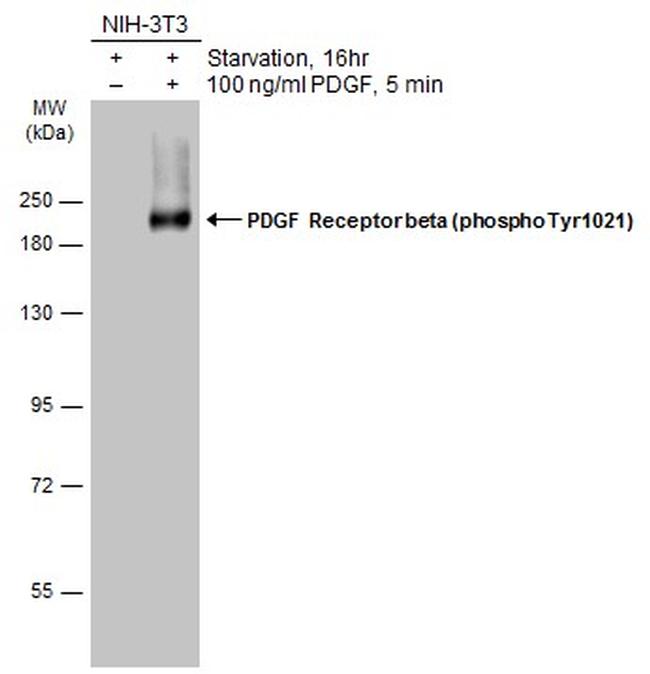 Phospho-PDGF Receptor beta (Tyr1021) Antibody in Western Blot (WB)