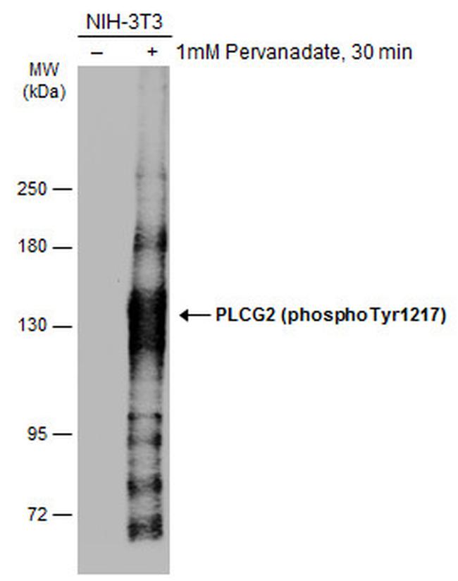 Phospho-PLCG2 (Tyr1217) Antibody in Western Blot (WB)