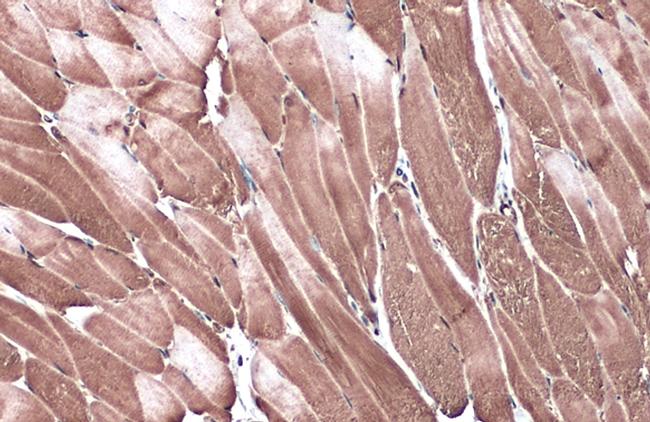 C3G Antibody in Immunohistochemistry (Paraffin) (IHC (P))