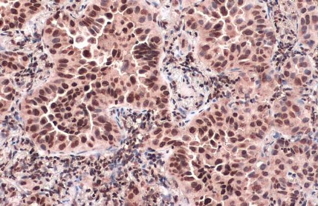 CENPA Antibody in Immunohistochemistry (Paraffin) (IHC (P))