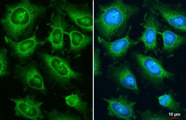 AJUBA Antibody in Immunocytochemistry (ICC/IF)