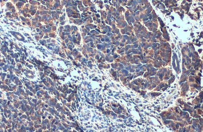 Alix Antibody in Immunohistochemistry (Paraffin) (IHC (P))