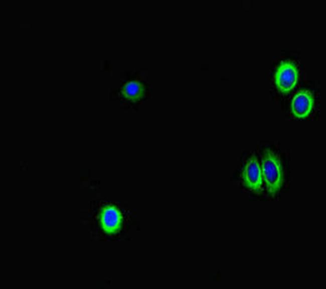 GAA Antibody in Immunocytochemistry (ICC/IF)