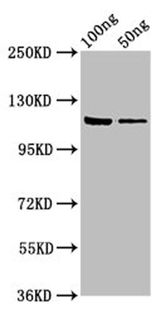 E. coli GLB1 Antibody in Western Blot (WB)