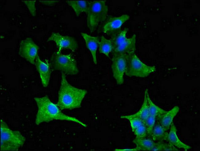 GNAT1 Antibody in Immunocytochemistry (ICC/IF)