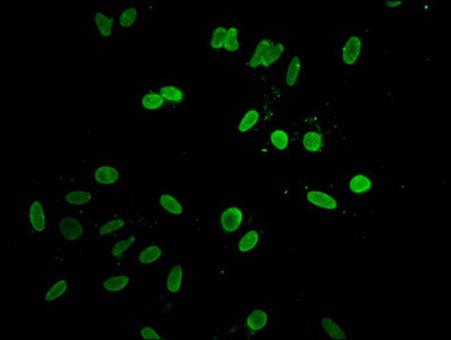 Histone H1.3 Antibody in Immunocytochemistry (ICC/IF)