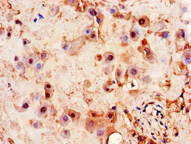 PITX3 Antibody in Immunohistochemistry (Paraffin) (IHC (P))