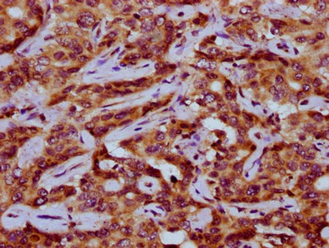 PEX11A Antibody in Immunohistochemistry (Paraffin) (IHC (P))