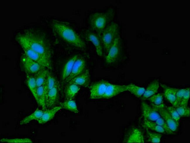 PKA beta Antibody in Immunocytochemistry (ICC/IF)