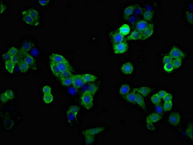 GLT-1 Antibody in Immunocytochemistry (ICC/IF)