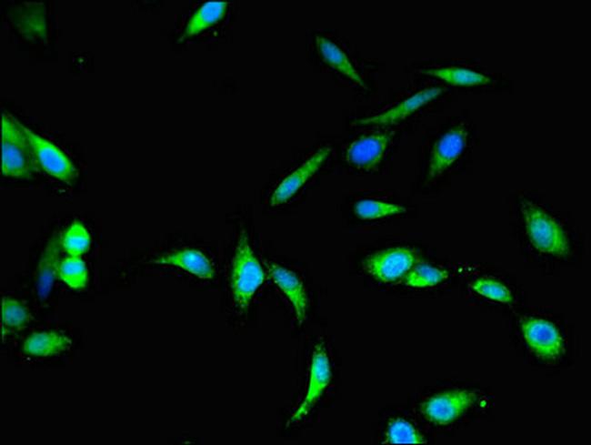 BHMT2 Antibody in Immunocytochemistry (ICC/IF)