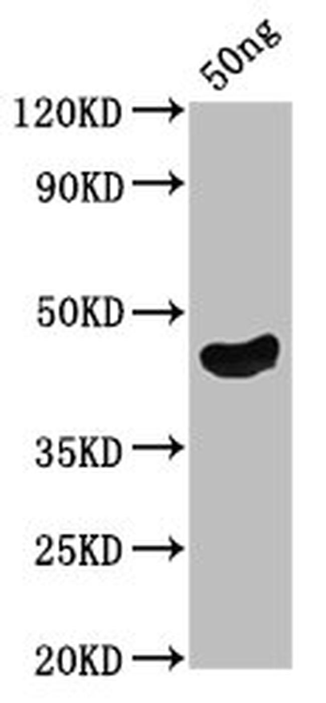 Pseudomonas aeruginosa oprF Antibody in Western Blot (WB)