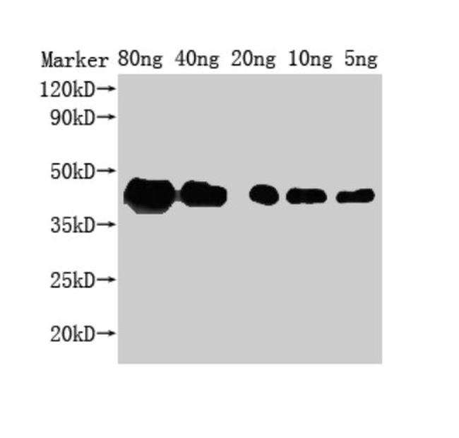 Saccharomyces cerevisiae ZIP1 Antibody in Western Blot (WB)