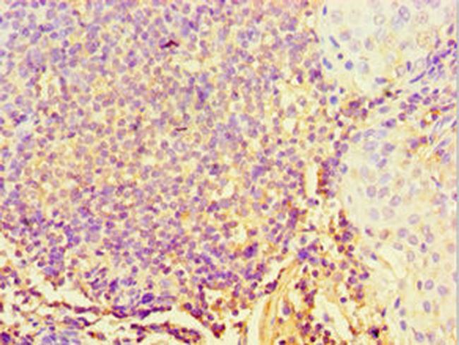 STARD3 Antibody in Immunohistochemistry (Paraffin) (IHC (P))