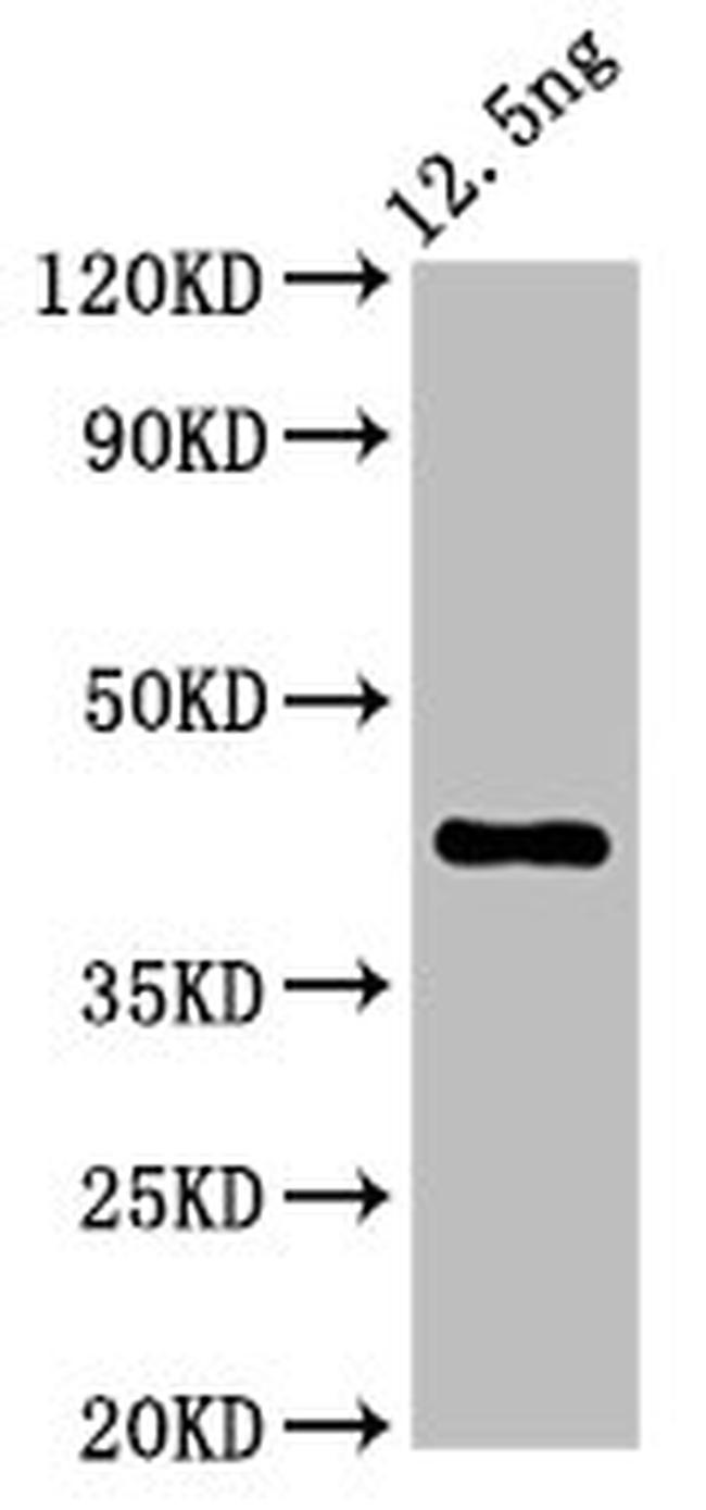 Arabidopsis thaliana ZAR1 Antibody in Western Blot (WB)