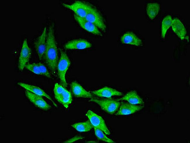 CMBL Antibody in Immunocytochemistry (ICC/IF)