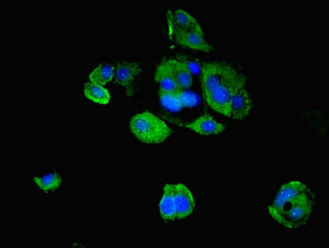 MID2 Antibody in Immunocytochemistry (ICC/IF)