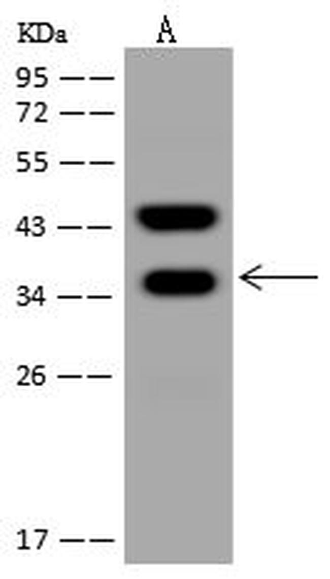 AASDHPPT Antibody in Western Blot (WB)