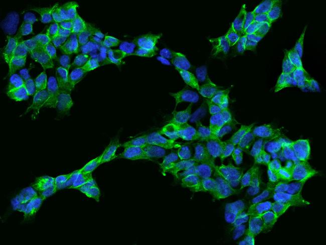 GADD34 Antibody in Immunocytochemistry (ICC/IF)