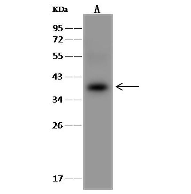 AKR1B10 Antibody in Western Blot (WB)