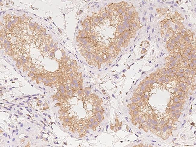 AP2A2 Antibody in Immunohistochemistry (Paraffin) (IHC (P))