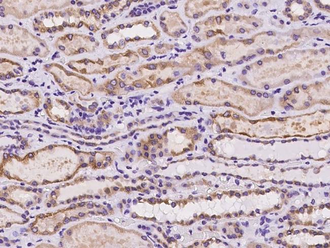 BAP29 Antibody in Immunohistochemistry (Paraffin) (IHC (P))