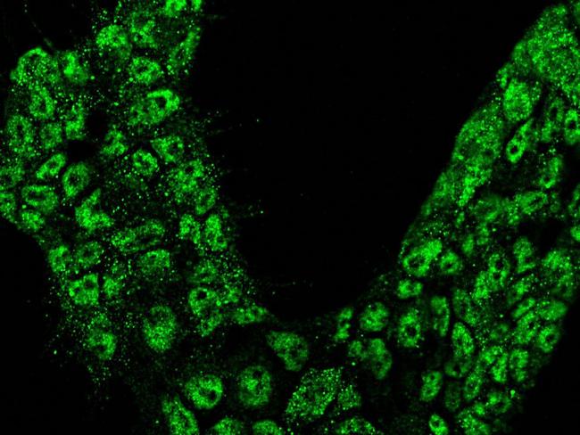 Calbindin Antibody in Immunocytochemistry (ICC/IF)